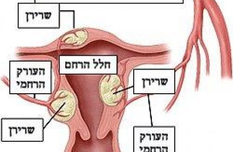 היו שרירנים ואינם – הסיפור האישי שלי